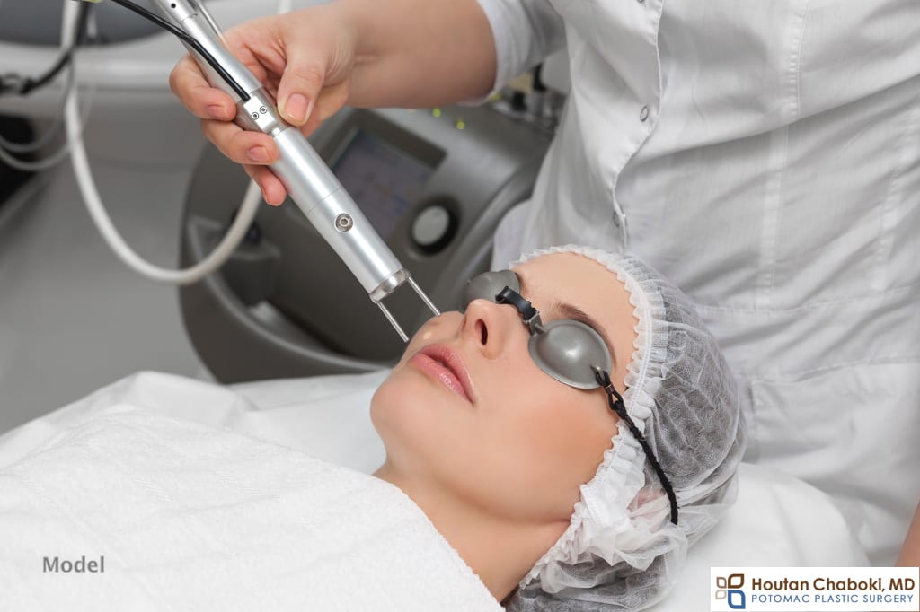 Blog post - laser rejuvenation resurface nonablative fractional fraxel CO2 erbium model