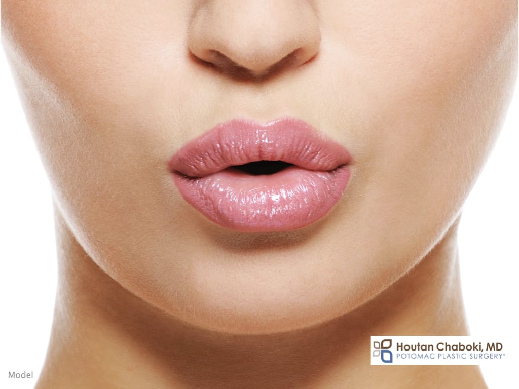Blog - lip enhancement injection facial filler ideal lip shape attractive