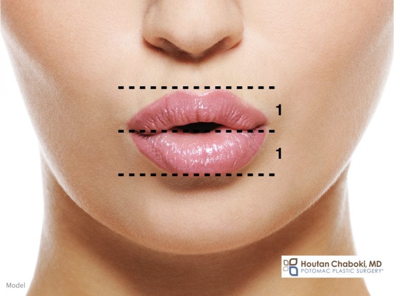The Ideal Lip Shape in Plastic Surgery