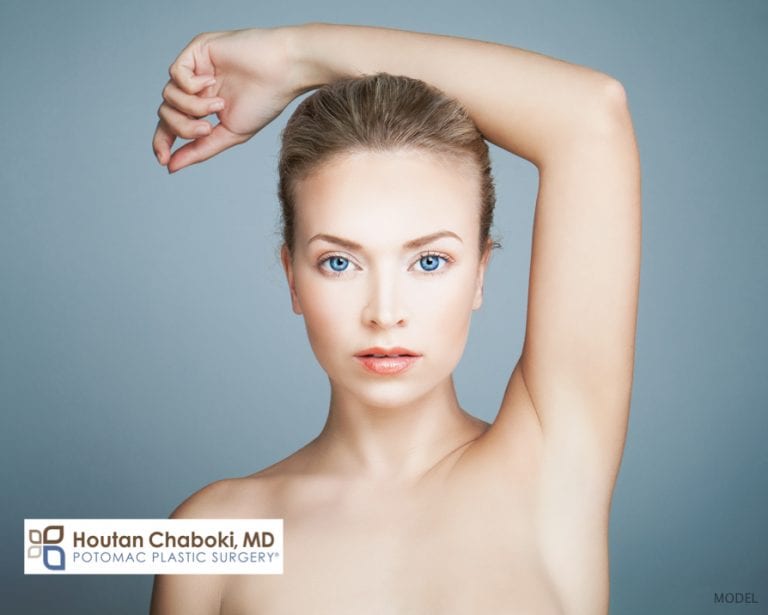 Botox for Excess Underarm Sweating