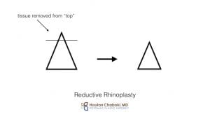 Preservation rhinoplasty closed nose surgery Chaboki