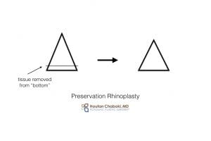 Preservation rhinoplasty closed nose surgery Chaboki